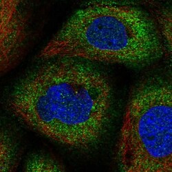 CNKSR1 Antibody, Novus Biologicals 25 &mu;L; Unlabeled:Antibodies, Polyclonal